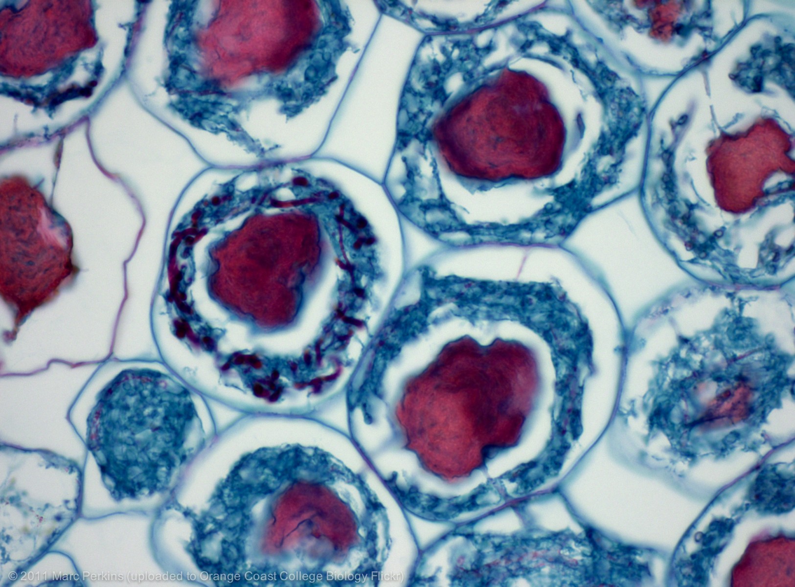 mycorrhizal microbes